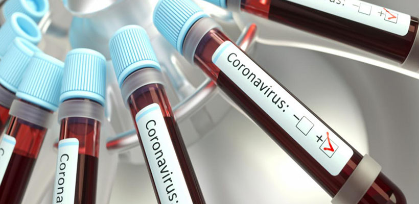 coronavirus-analisisjpg