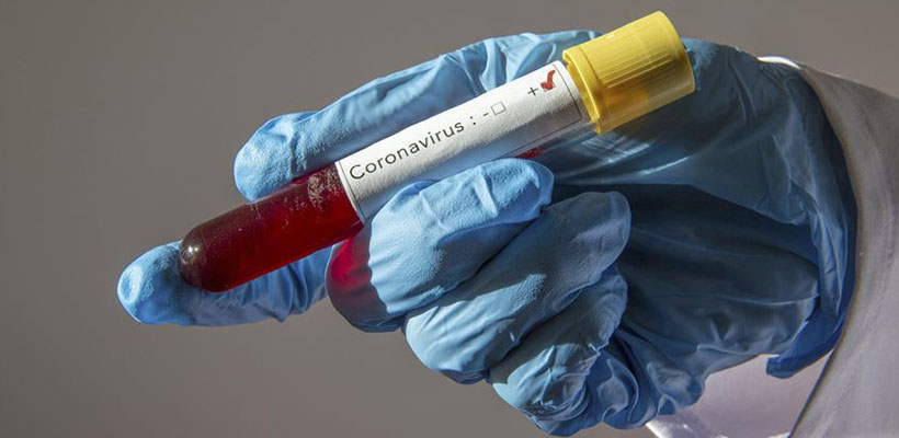 coronavirus-positivo-san-pedrojpg