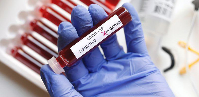 covid-19-negativo-coronavirusjpg