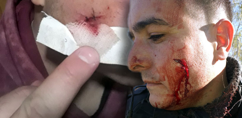 policia-agredidojpg