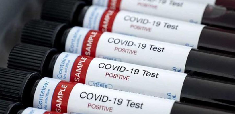 test-covid-1jpg