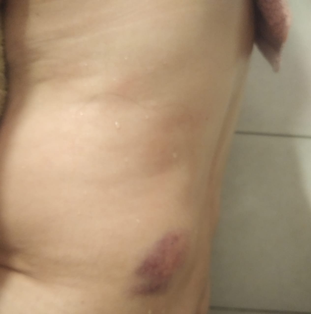 GOLPEAN MUJER 1.jpg