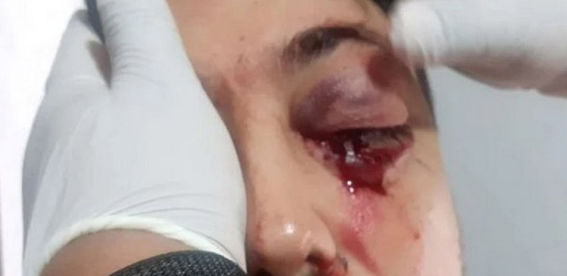 pelea-escuelajpg